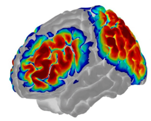 Measuring Hearing Aid Benefits for the Brain