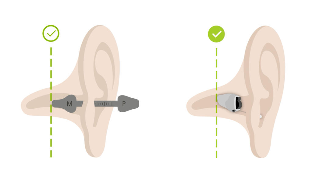 About the new Phonak Virto™ B-Titanium hearing aid